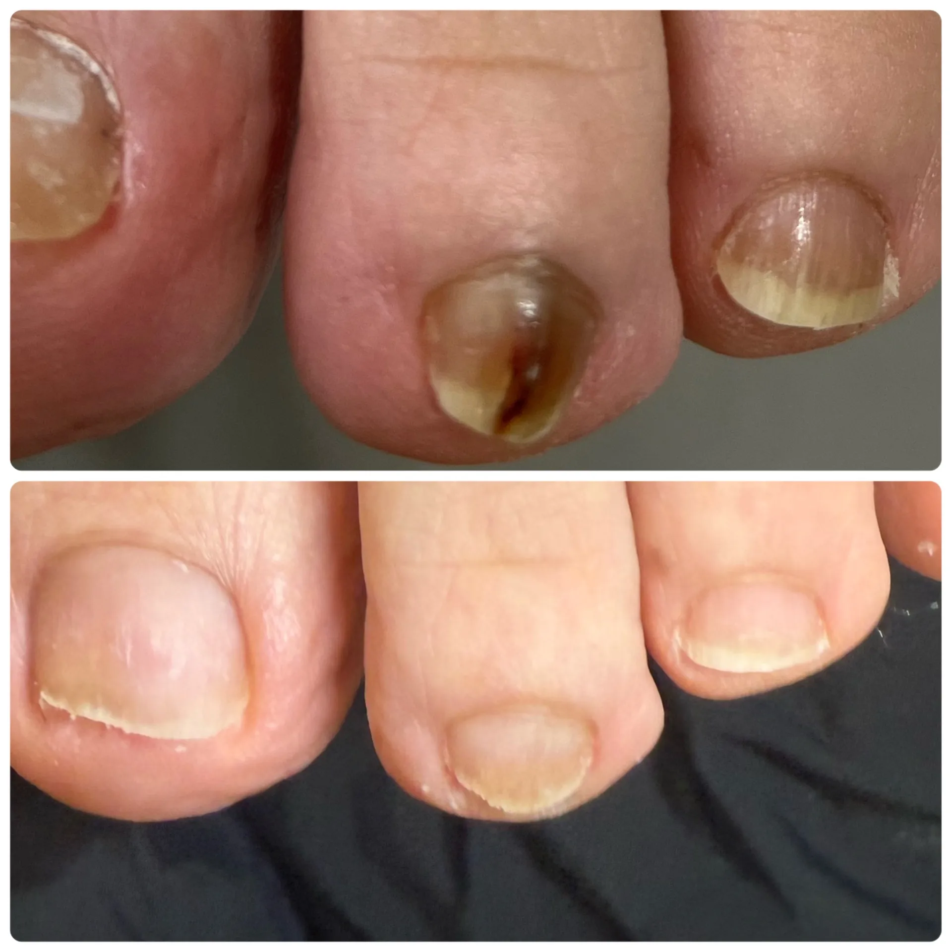 人前で素足になるのが恥ずかしい方！