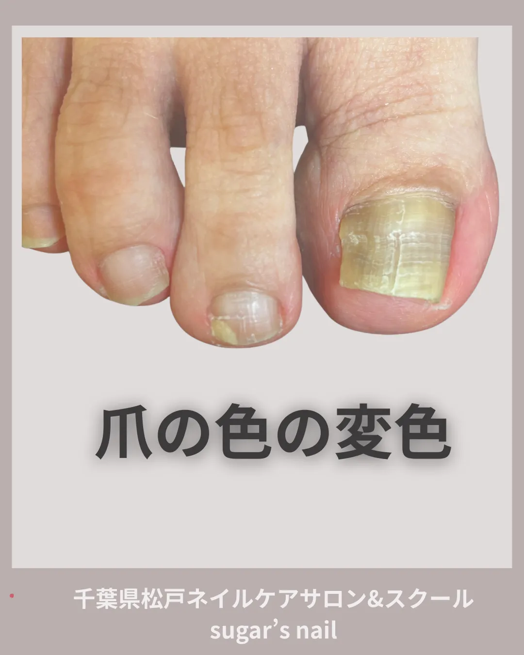 爪の色大丈夫？